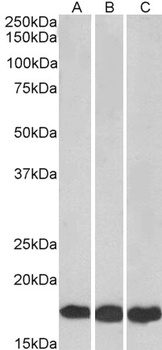 UBE2L3 Antibody