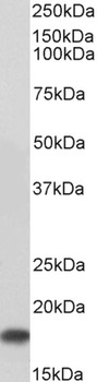 UBE2I Antibody