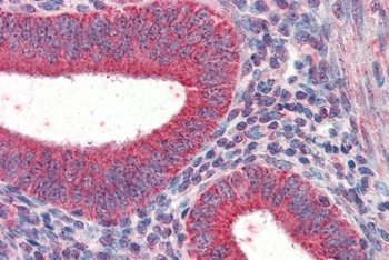 TRIM5 Antibody