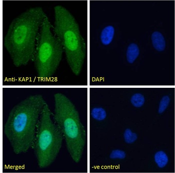 TRIM28 Antibody