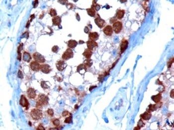 TCP1 Antibody