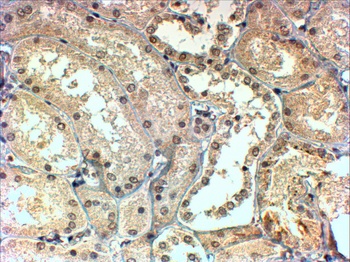 TBL1X Antibody