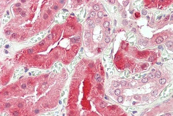 STAT3 Antibody
