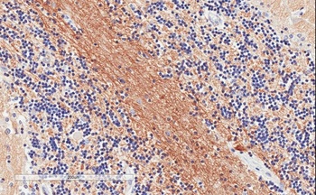 SNAP25 Antibody
