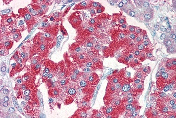 VMAT2 Antibody