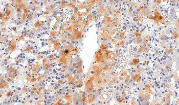 VMAT2 Antibody