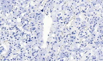 SLC18A2 Antibody