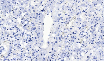 VMAT2 Antibody