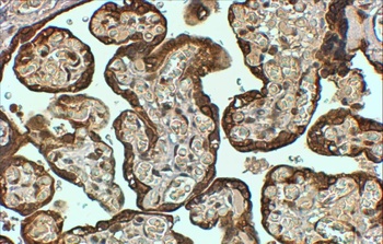 SERPINE1 Antibody