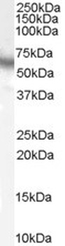 RPS6KB1 Antibody