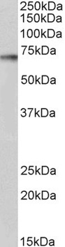 RPS6KB1 Antibody