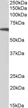 RPS6KB1 Antibody