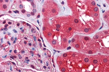 Radixin Antibody