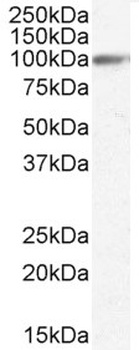 Radixin Antibody
