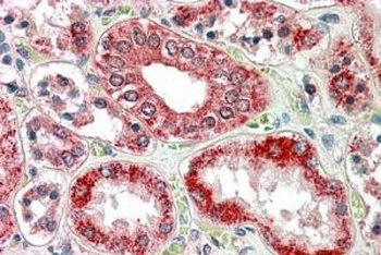 RANBP1 Antibody