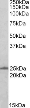 RAN Antibody