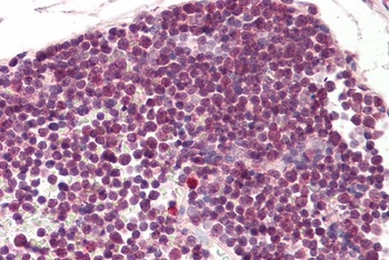 RAN Antibody