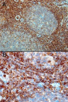 RAC2 Antibody