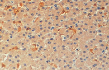 PYCARD Antibody