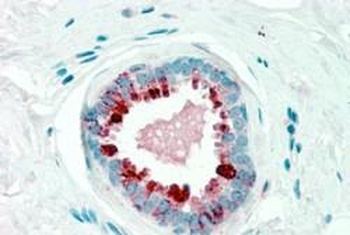 PIP Antibody