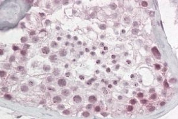 Pescadillo Antibody