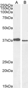 PCGF2 Antibody