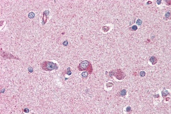 PAFAH1B1 Antibody