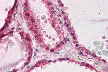 PAFAH1B1 Antibody