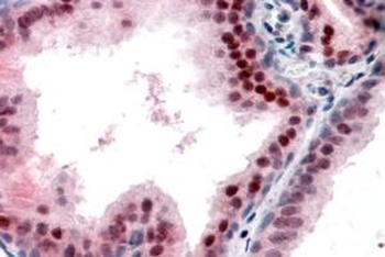 CDKN1B Antibody