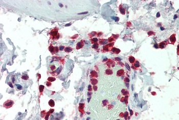 NCF1 Antibody