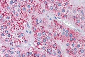 MTA1 Antibody