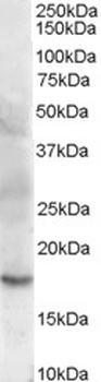 MMP-7 Antibody