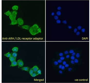 LDLRAP1 Antibody