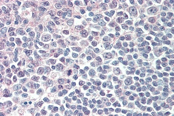 IRF8 Antibody