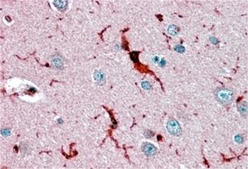 GPX1 Antibody