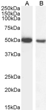 GFAP Antibody