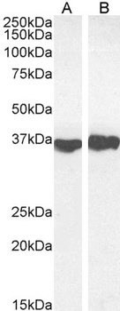 GAPDH Antibody