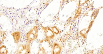 GAPDH Antibody