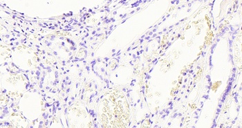 GAPDH Antibody