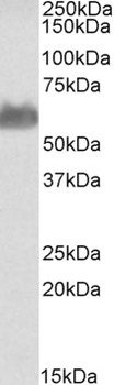 FTCD Antibody