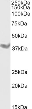 ERBB3 Antibody