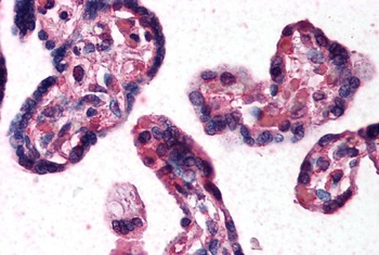 DKK1 Antibody