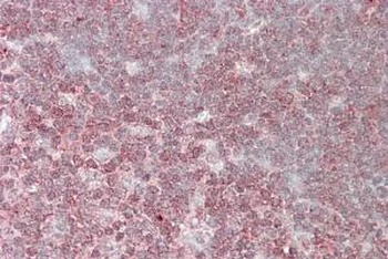 CRKL Antibody