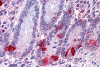 Chromogranin A Antibody
