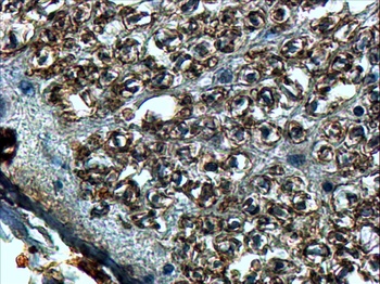 Chromogranin A Antibody