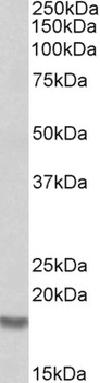 Cofilin 2 Antibody
