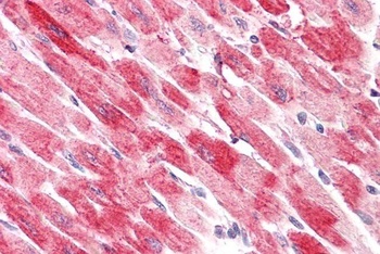 Cofilin 2 Antibody