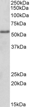 Cofilin 2 Antibody