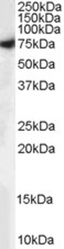 CDKN1B Antibody