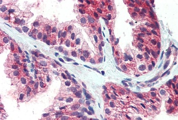 CDCP1 Antibody